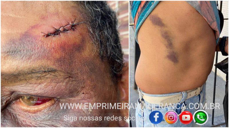 Trabalhador é agredido com cadeiradas durante roubo de celular em Franca